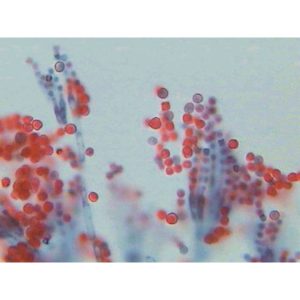 Aspergillus Sp. (eurotium) Section On