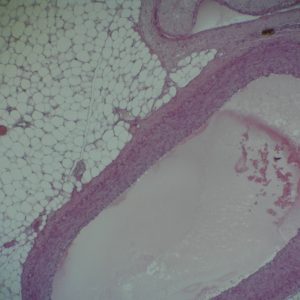Aorta Distributive Artery And Vein Ts