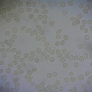 Unstained Blood Smear